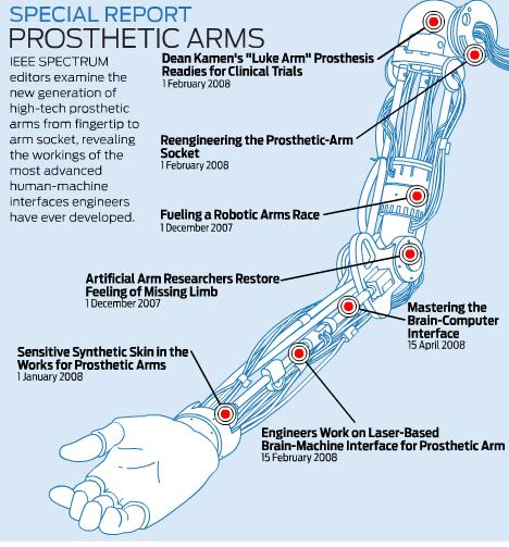 Arm Prosthetics