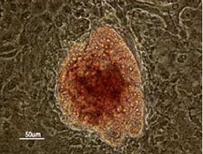 Researchers Reprogram Pancreas Cells to Produce Insulin Researchers Reprogram Pancreas Cells to Produce Insulin