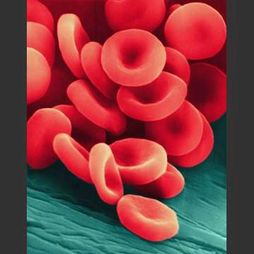 What are the causes of enlarged red blood cells in hematology?