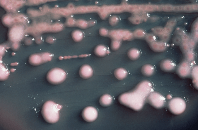 Antibiotic Resistant Bacteria. Rise of Antibiotic-Resistant