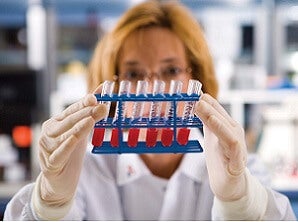 blood-test-alzheimers