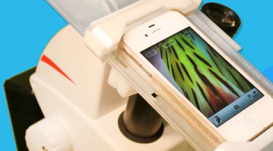 SkyLight Adapter Connects Microscopes To Smartphones