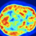 brain-spaun