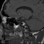image1A