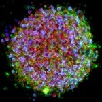 stem cells