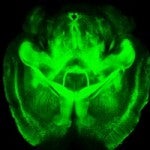 brain