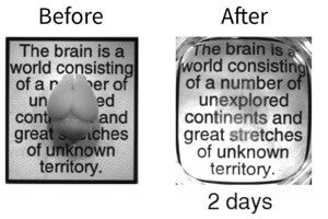 New Technique Turns Brain Transparent, Gives Scientists Direct Look Into Brain