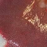 liver