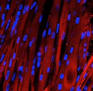 Working Lab-Grown Human Muscles to Serve as 'Clinical Trials in a Dish'
