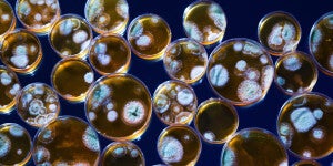 Why We Should Embrace -- Not Fear -- the Biohacker Uprising