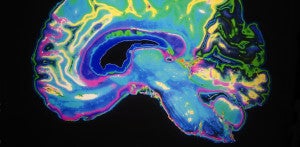 Naughty or Nice? One Brain Scan Is Now All It Takes to Find Out