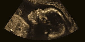 Exponential Medicine: What to Expect When You're Expecting Designer Babies