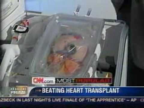 TransMedics: Transplanting a Real Beating Heart