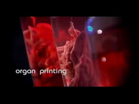 Organovo Pioneers 3-D Organ Printing: Hype or Hope?