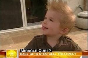 cerebral-palsy-stem-cells-cord-blood-dallas-hextell