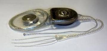 cochlear-balance-implant