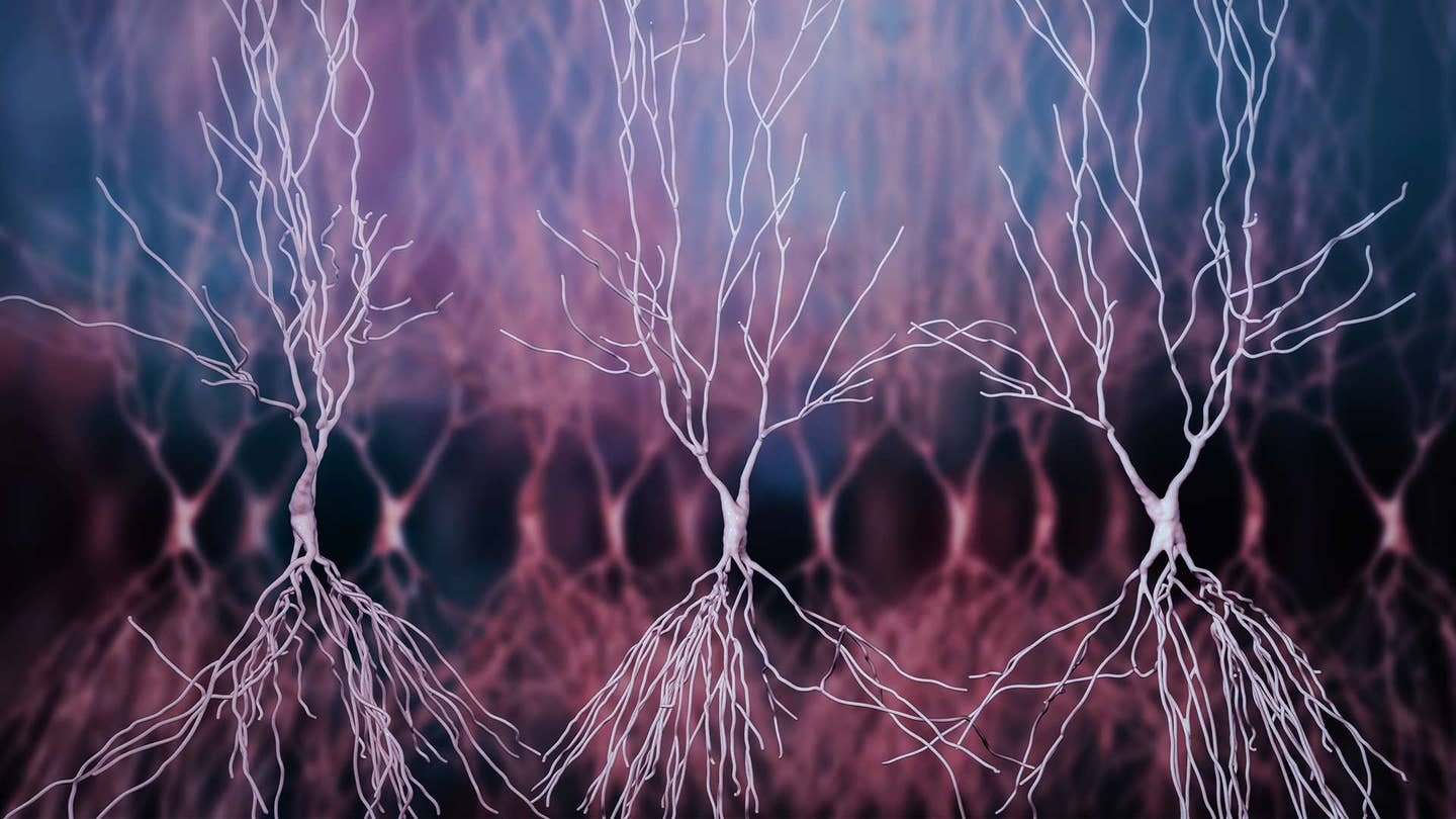 3D computer reconstruction human hippocampus neurons