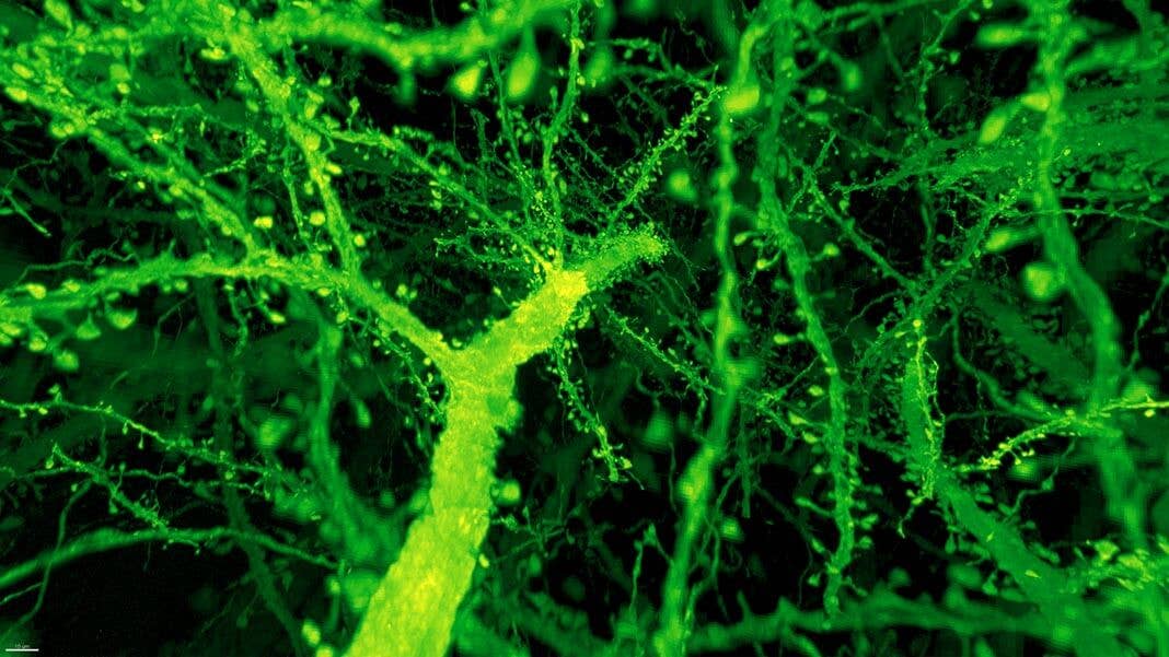 AAAS Gao et al Dendritic spines