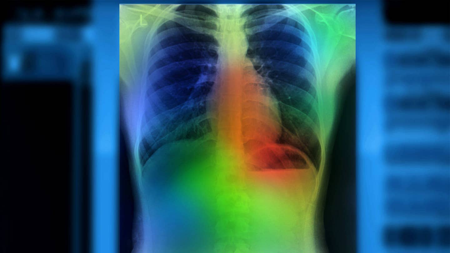 artificial intelligence smart healthcare technology longevity Peter Diamandis