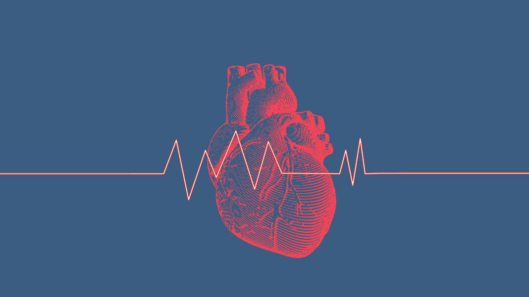 CRISPR gene therapy for heart attacks