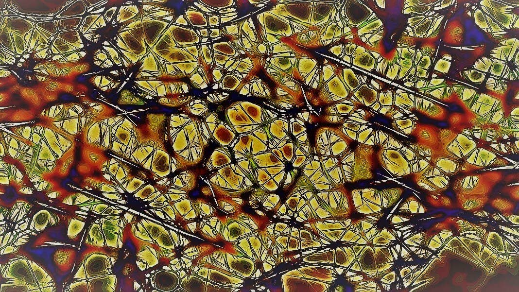 human neurons dendrites brain neuroscience