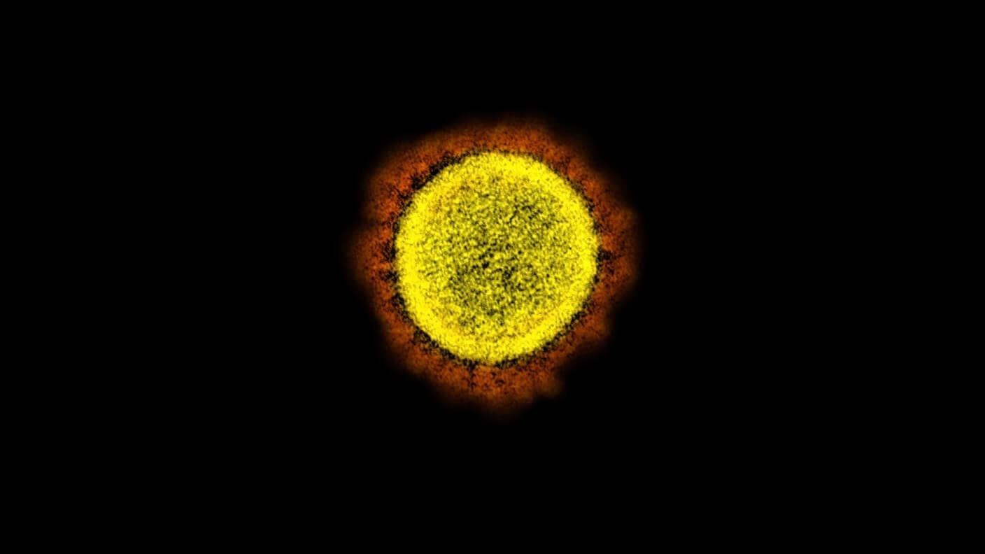 next pandemic yellow red black coronavirus nih