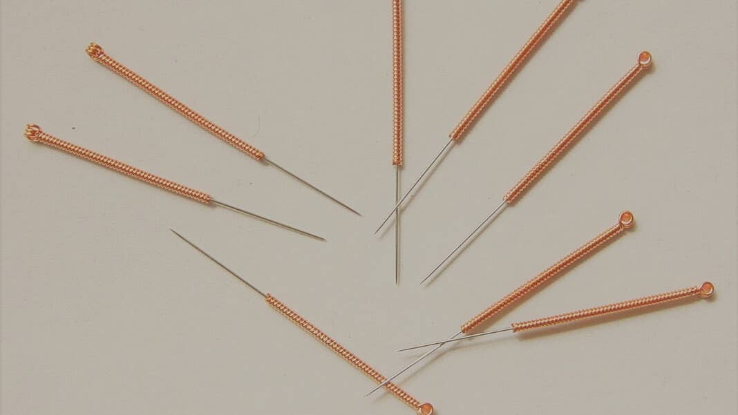 acupuncture