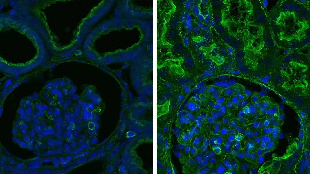 restored tissues pig organs