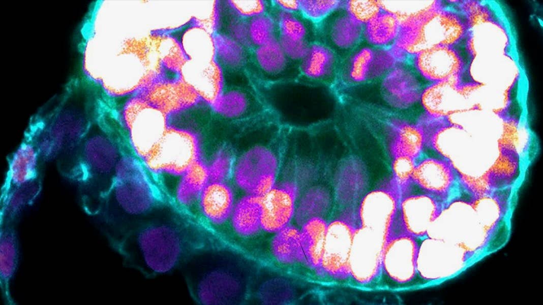 human embroid embryo models