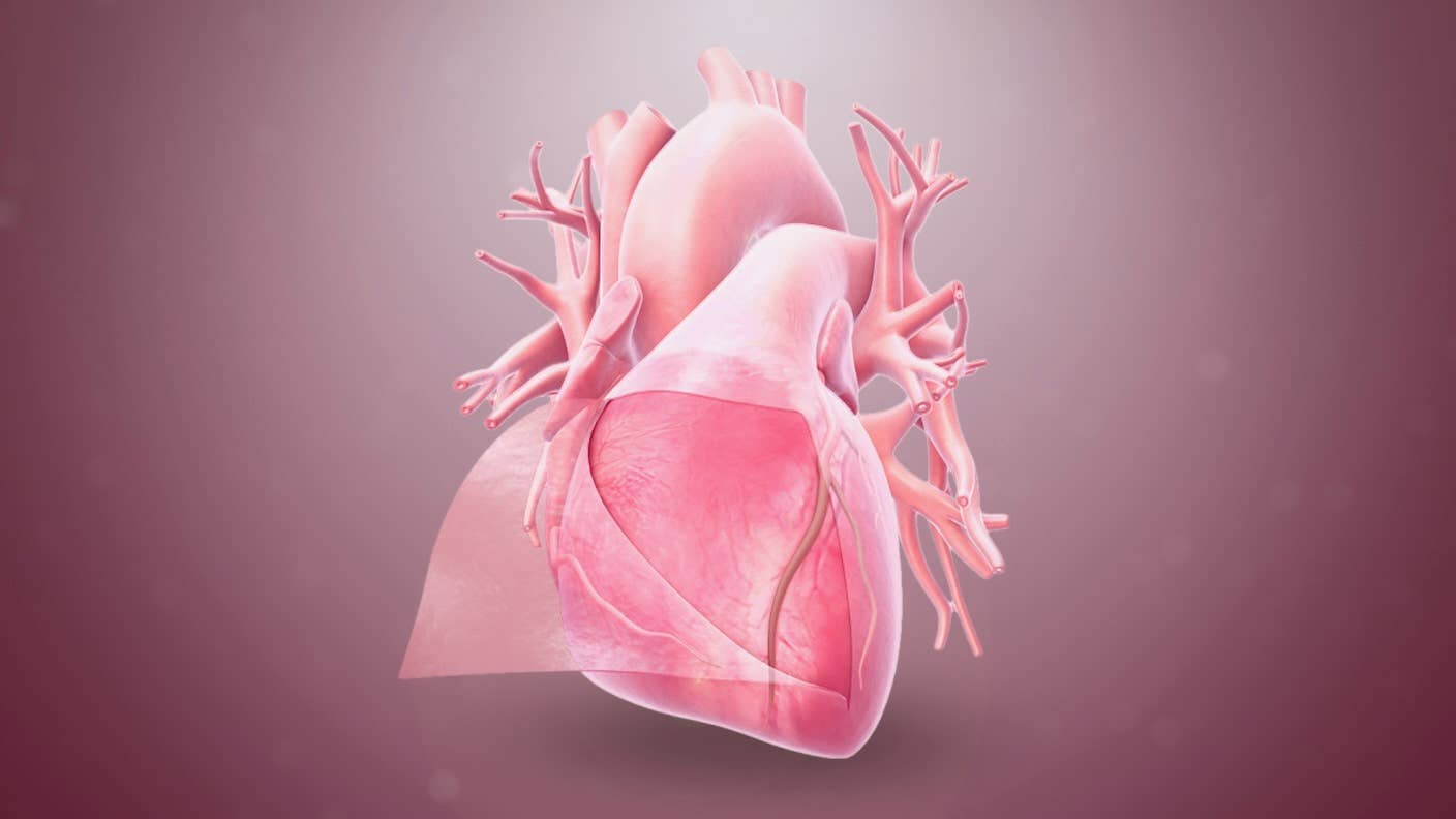 gene editing base editing human trial cholesterol heart disease
