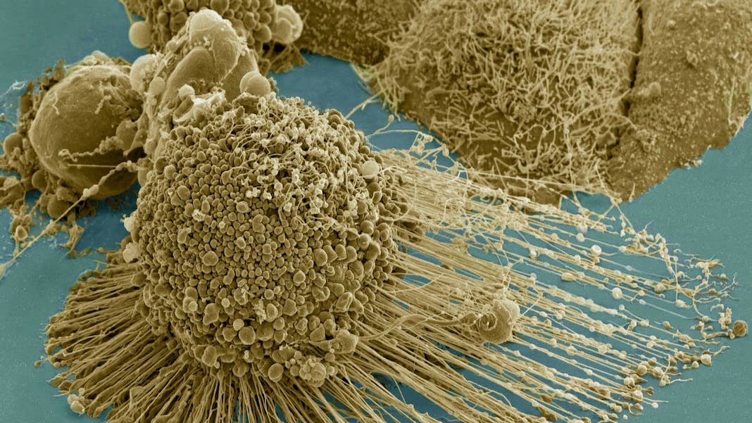 longevity anti-aging senescent cells therapy