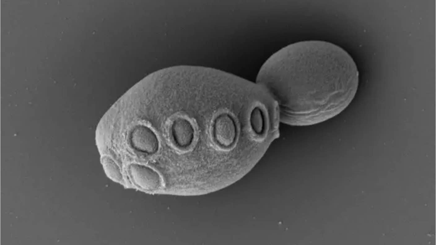 synthetic biology synthetic chromosomes DNA eukaryotes yeast