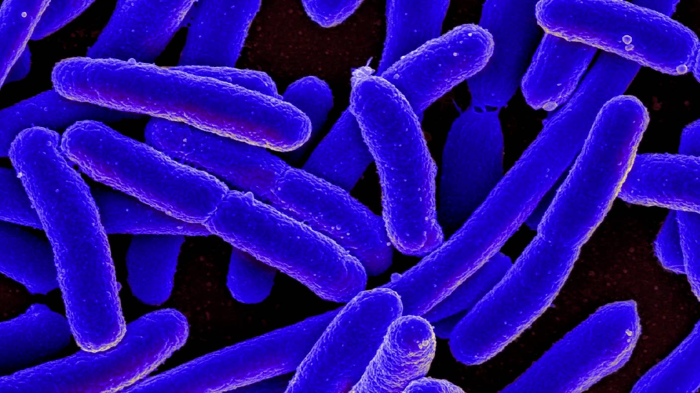 exotic amino acids proteins in e. coli bacteria
