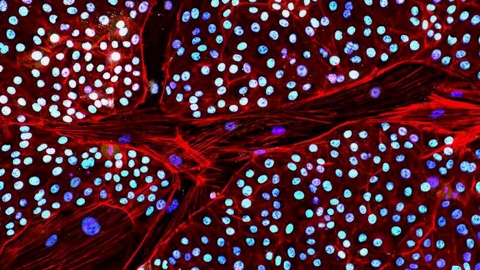 De-extinction biotechnology company, Colossal, has made the first induced pluripotent stem cells out of elephant cells.