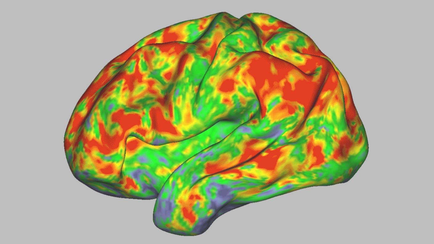 In a new study, scientists scanned the brains of 7 people over several weeks to see how psilocybin changed their brain activity.