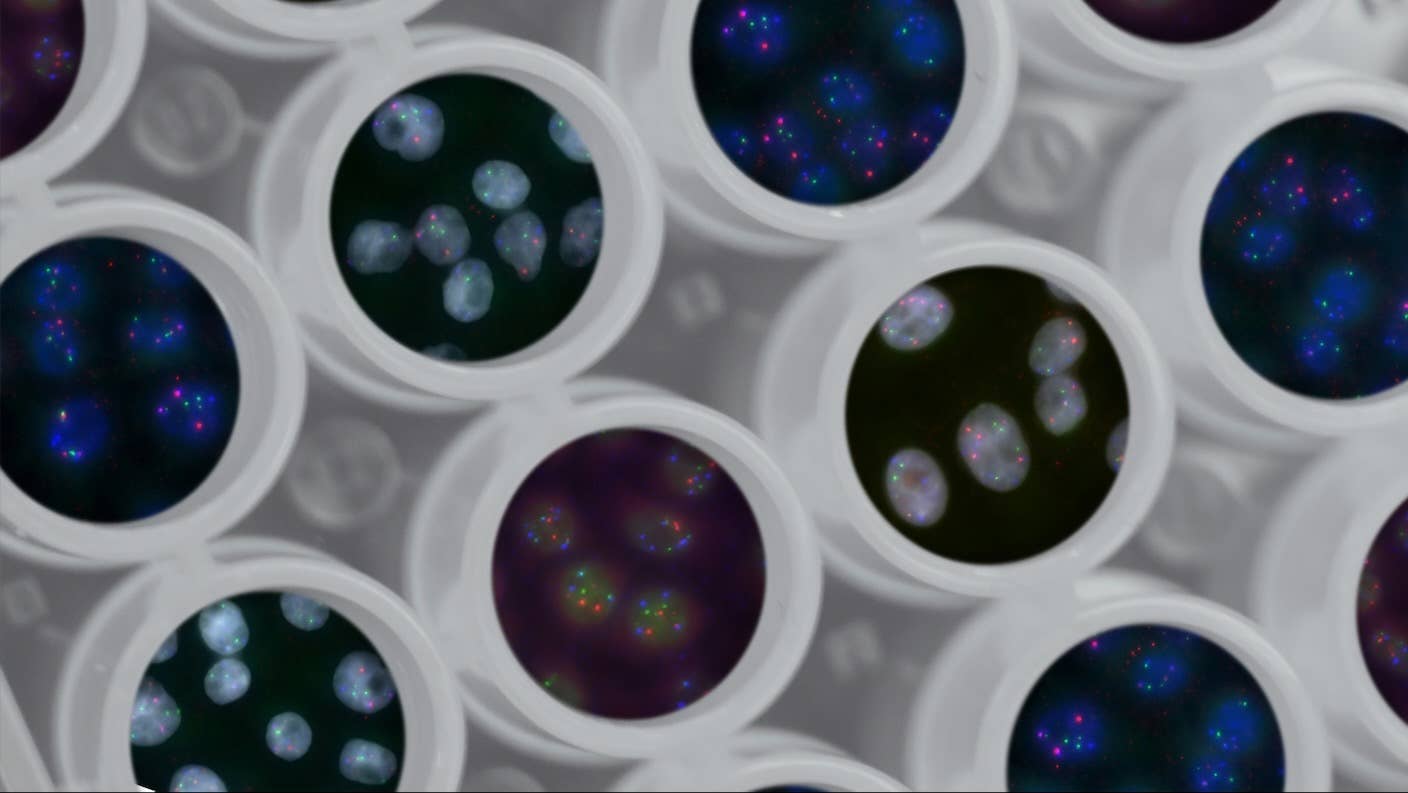 What Does Every Human Gene Do? This Massive Project Is About to Find Out Cells in wells with genes highlighted in 3D