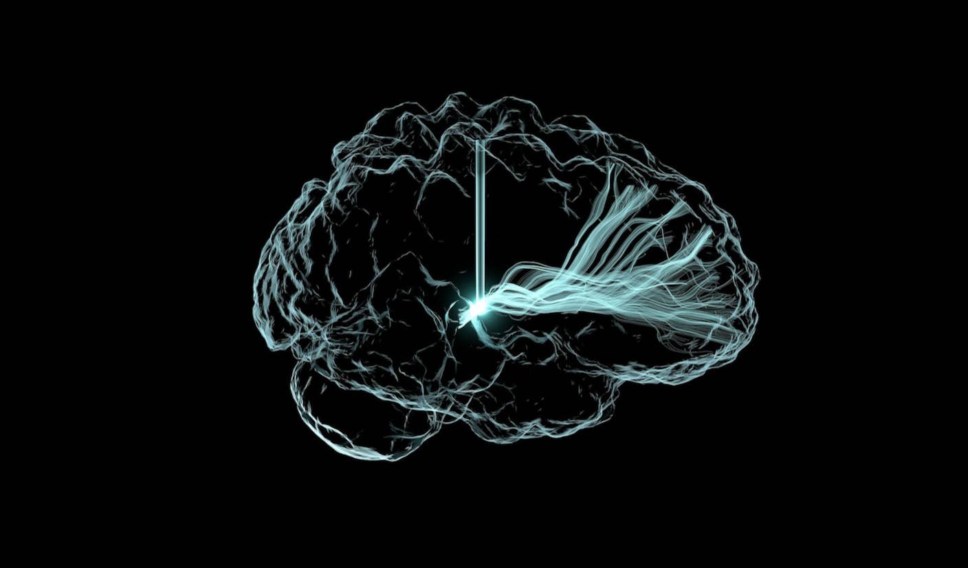 Our Conscious Perception of the World Depends on This Deep Brain Structure Deep stimulation in the brain