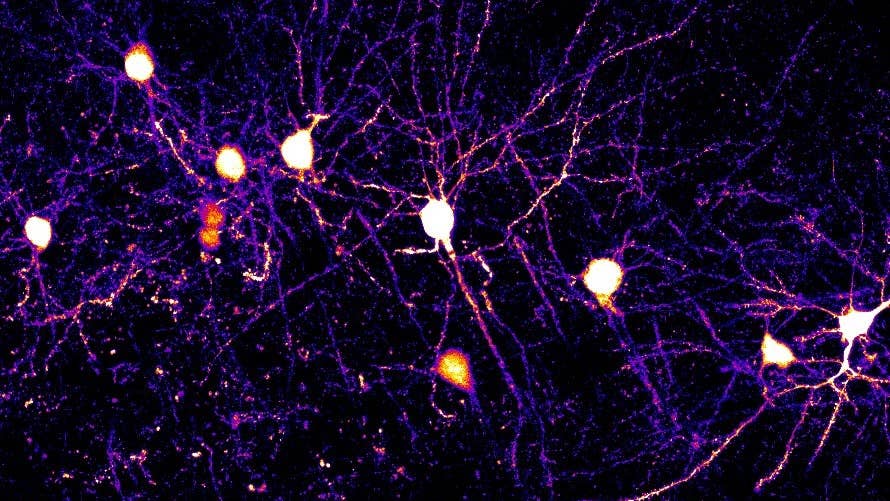 Each of the Brain’s Neurons Is Like Multiple Computers Running in Parallel A tangled network of the brain's neurons and their connecting dendrites