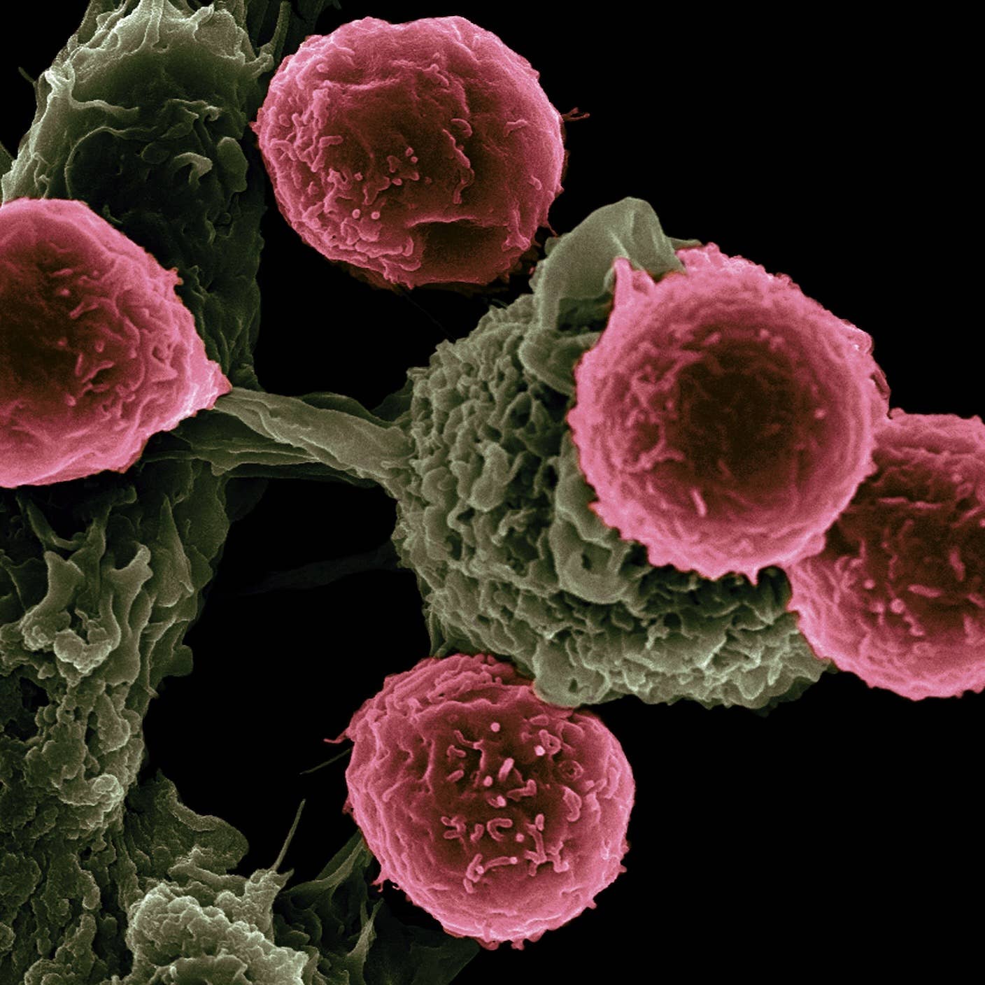 A scanning electron microscope image of T cells (pink) and dendritic cells