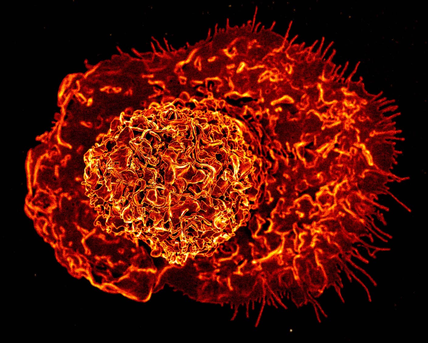 A scanning electron micrograph of a macrophage immune cell