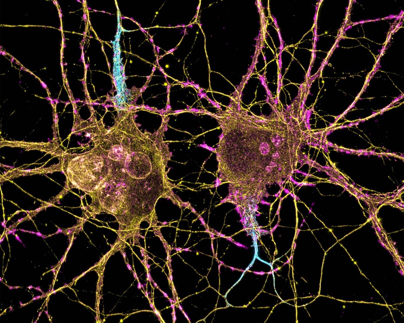 Image of neurons