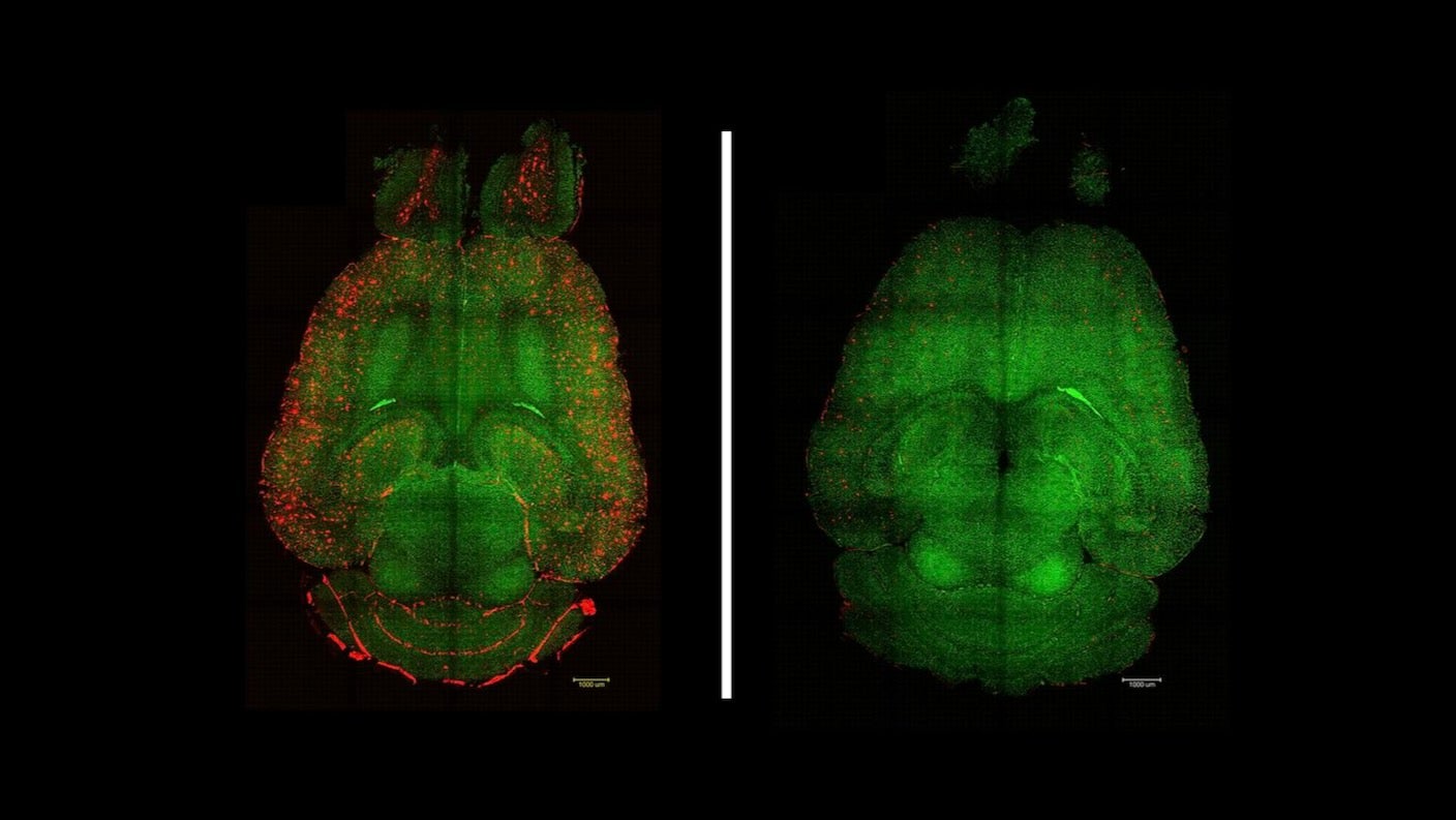 Plaques (red) cleared from vessels (green) in mice. Untreated brain (left) and treated brain (right) / Institute for Bioengineering of Catalonia (IBEC)
