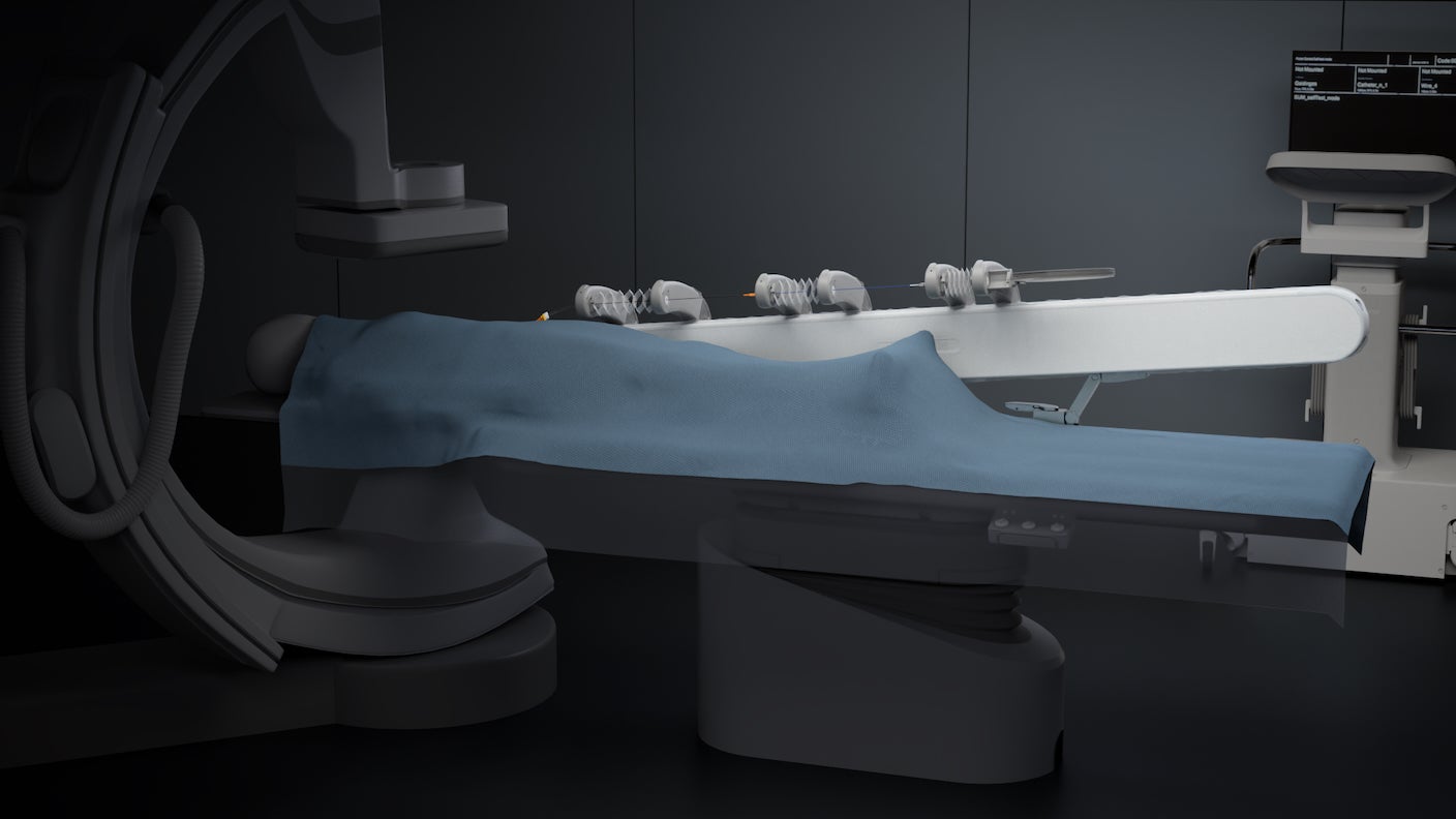 A surgeon used a surgical robot to complete a stroke surgery on a brain 4,000 miles away.