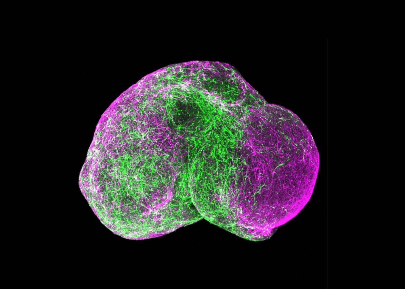 A brain organoid mimicking the 3D structure of the brain