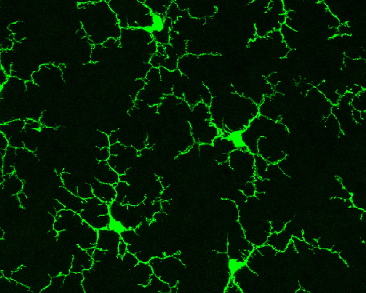 Healthy microglia in a mouse retina