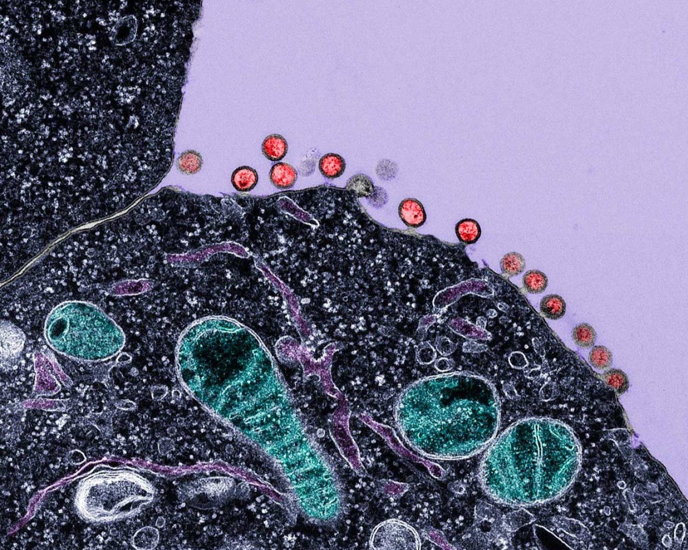 New Immune Treatment May Suppress HIV—No Daily Pills Required HIV viruses emerge from an infected cell