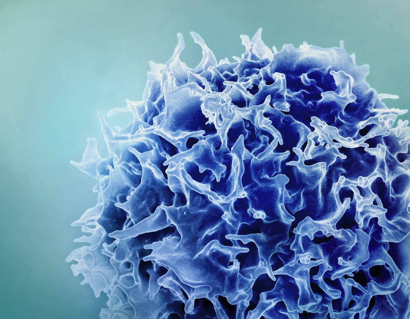 Single Injection Transforms the Immune System Into a Cancer-Killing Machine A scanning electron micrograph of a T cell.