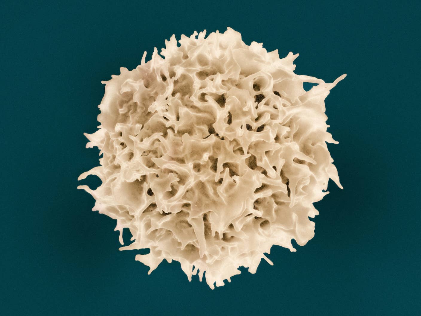 Aging Weakens Immunity. An mRNA Shot Turned Back the Clock in Mice. A scanning micrograph image of a T lymphocyte