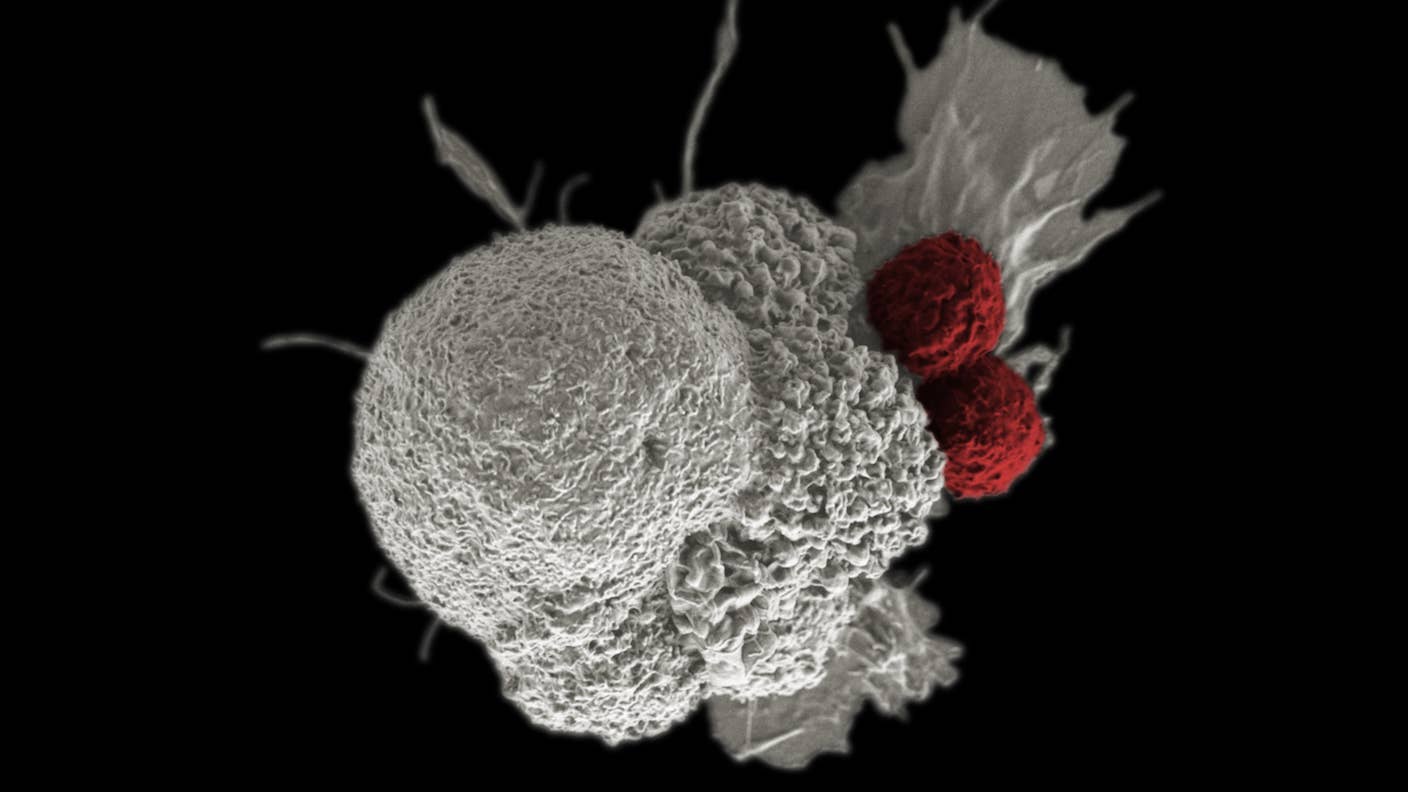 In First Human Trial, Zombie Cancer Cells Train the Body to Fight Tumors Two T cells attack a cancer cell