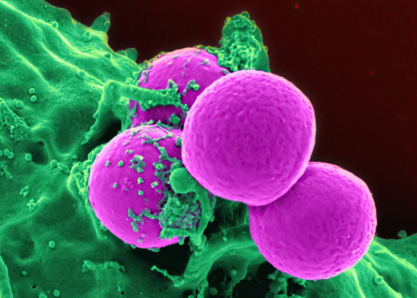 A cluster of methicillin-resistant staphylococcus aureus (MRSA) bacteria (magenta)